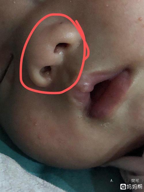 为什么新生儿宝宝鼻子里每天都有鼻屎？为什么鼻子会鼻屎的呢