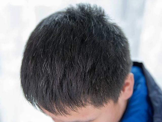 为什么中国人都是白发控？人为什么会白头发呢