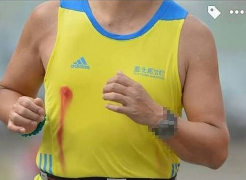 跑马拉松的人乳头为什么会出血？为什么流血呢-图2