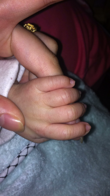 宝宝出生十天坐月子手指经常发胀怎么回事呢？为什么胎儿老是发胀呢呢