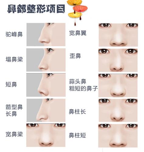 鼻子两边的纹路学名是什么？鼻子为什么不拉皮呢呢-图1