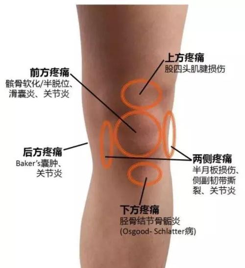 膝盖和膝盖周围疼痛是怎么回事？为什么膝盖总痛呢呢