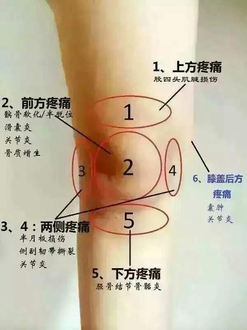 膝盖冷痛是什么原因？为什么膝盖怕冷呢-图1