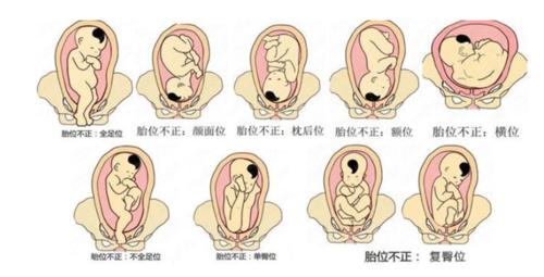 孕晚期胎动在左边正常吗？为什么胎动在左边多呢呢-图3