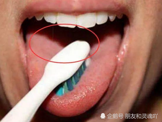 请问刷牙刷舌头怎么老是想吐呀？为什么刷牙总会想吐呢呢