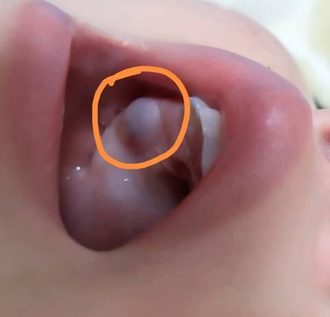 孩子牙龈痒怎么回事？小孩长牙为什么会痒呢呢