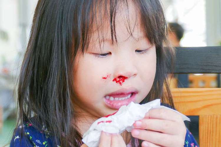 孩子总是流鼻血是什么原因？小孩为什么光流鼻血呢呢