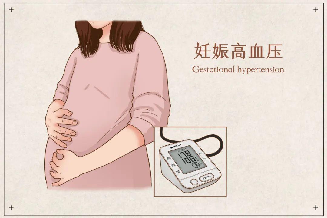 孕期为什么会水肿？怀孕为什么血压高呢呢-图2