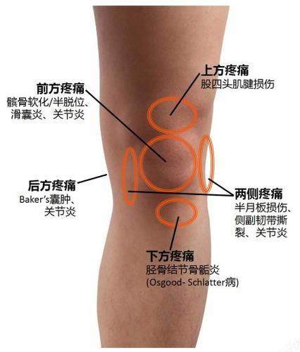 50岁左右女的膝盖痛脚肿是什么原因？50岁为什么膝盖痛呢呢-图3