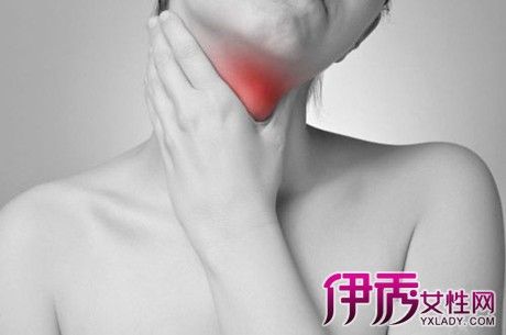 咽喉总有放射性疼痛的感觉，是为什么？为什么喉咙会经常痛呢呢-图3