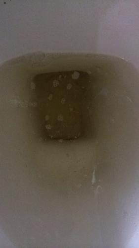 尿液里有很少很小的泡泡不消怎么回事？为什么尿里会有泡沫呢呢-图2