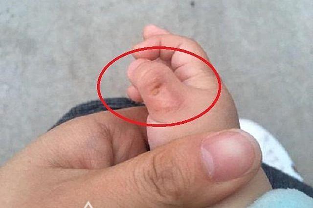两个月宝宝只吃左手怎么回事？不吃右手是什么原因？宝宝为什么不吃手呢