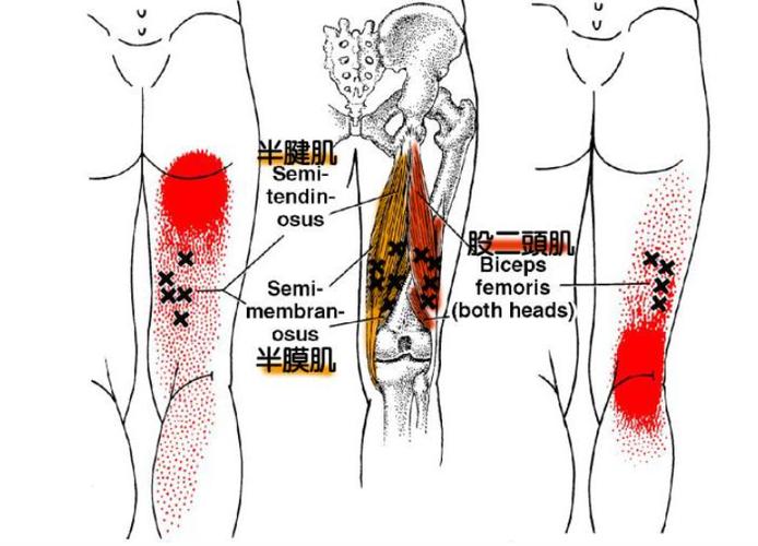 大腿后侧疼痛是怎么回事？为什么大腿还是疼呢