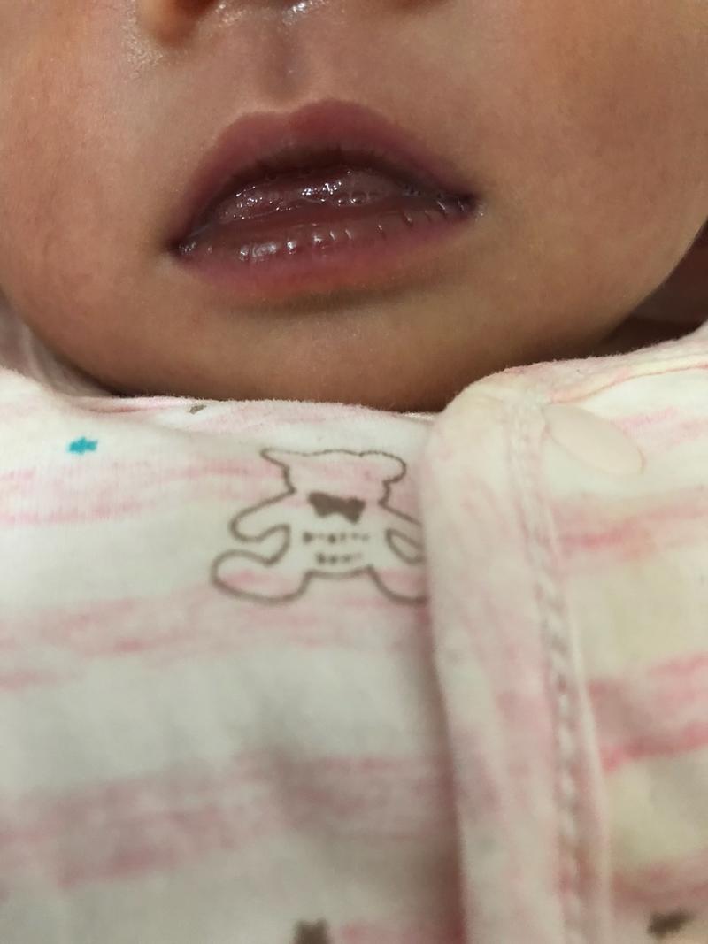 新生儿嘴唇正常是什么样子的呢？为什么嘴会有颜色呢-图3