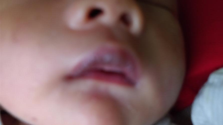 新生儿嘴唇正常是什么样子的呢？为什么嘴会有颜色呢-图2