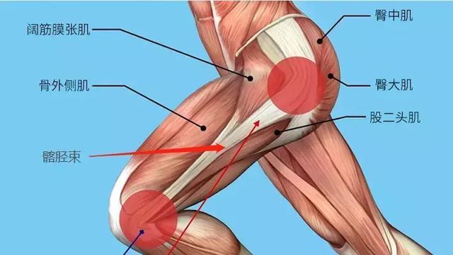 大腿上侧肌肉酸痛是怎回事？为什么大腿偶尔酸痛呢-图2