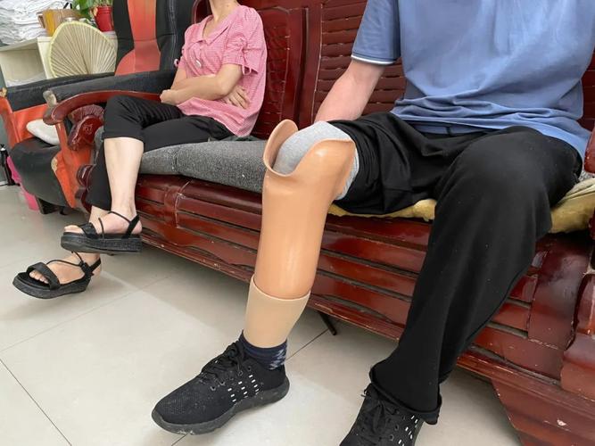北京哪家医院做假肢做的好？为什么假肢比较贵呢-图2