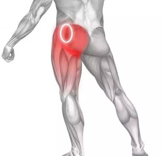 屁股大腿根肌肉疼痛是不是肾虚？为什么屁股根部痛呢