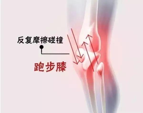 膝盖响是怎么回事?是缺钙么？膝盖里面为什么响呢