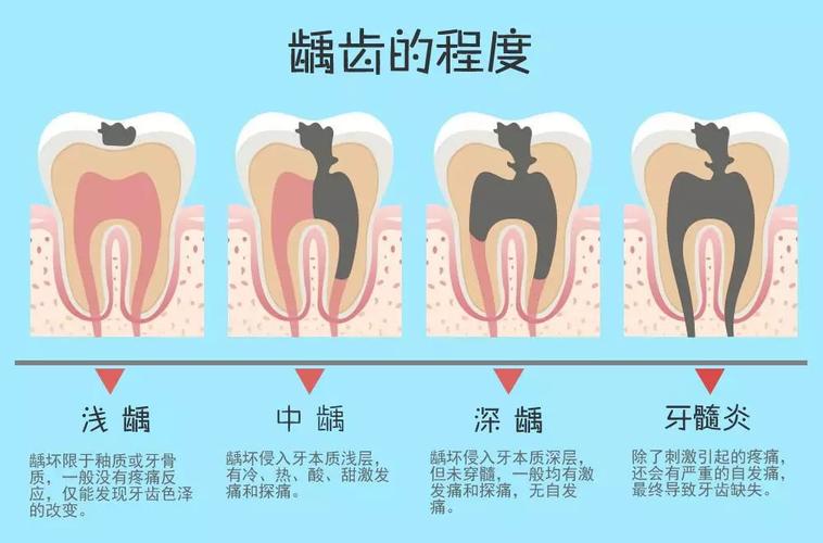 虫牙是怎么引起的？为什么会长蛀牙呢