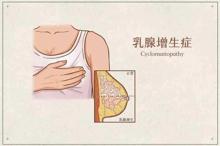 乳房酸痛是什么原因？为什么胸部很酸痛呢